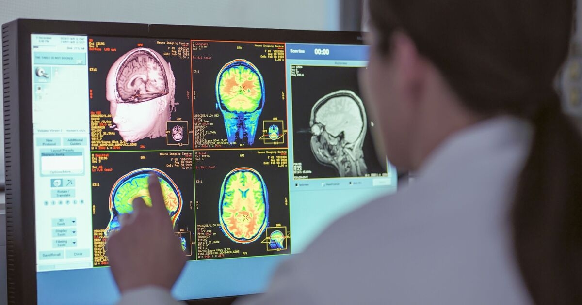 Two cancer drugs may reverse Alzheimer's brain changes — full study explained