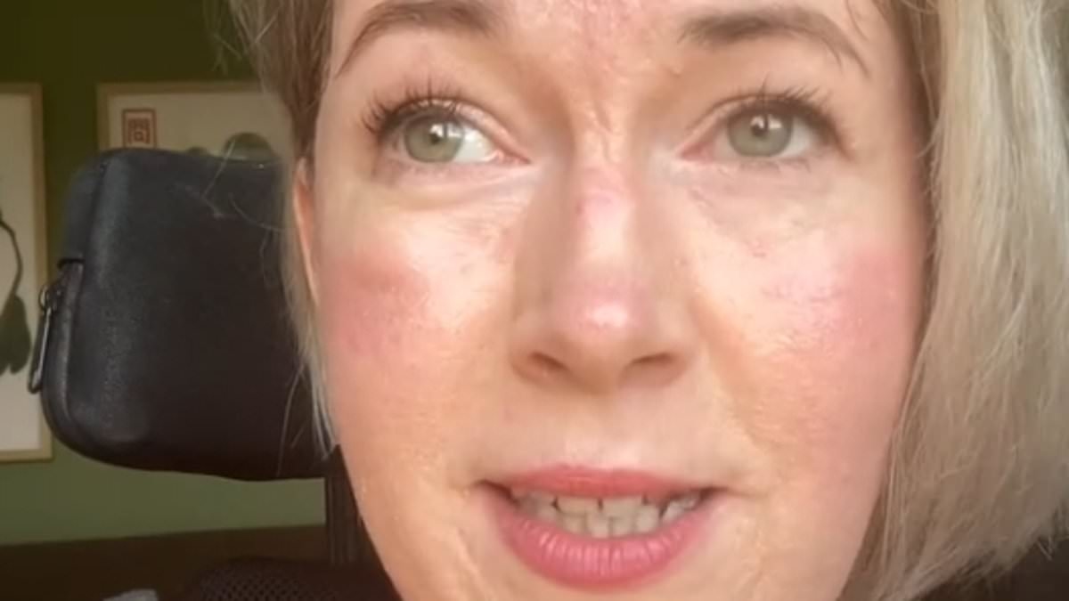 Mensen geschokt nadat gehandicapte vrouw beweert dat de NHS haar naar een dierenwinkel heeft gestuurd om gewogen te worden