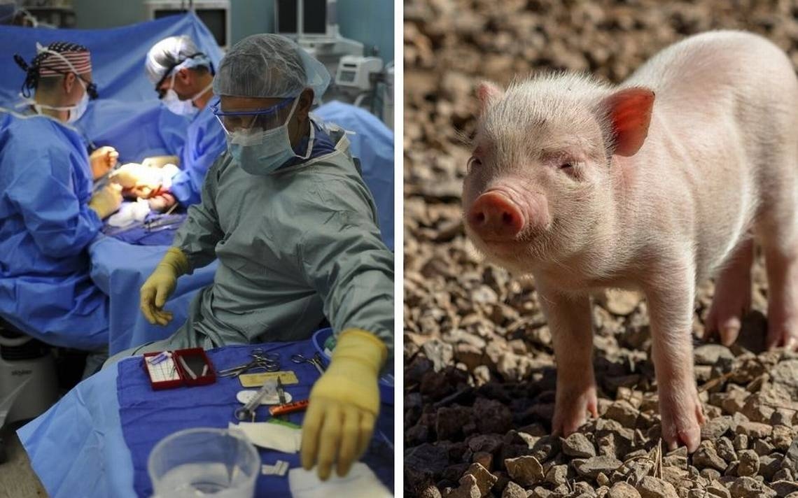 La Cina esegue il primo trapianto di polmone da maiale a uomo dopo la morte cerebrale