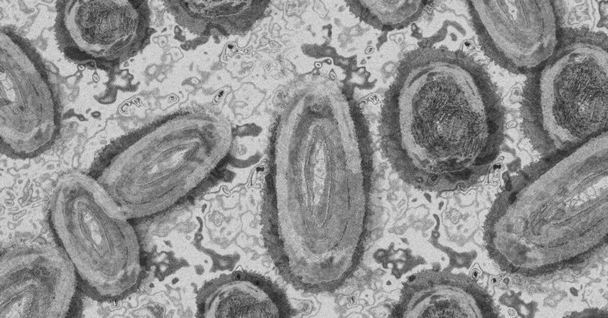 Le Pakistan décrète un confinement de 12 jours en raison d'une augmentation des cas de variole du singe