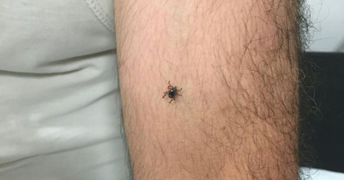 Kolejny przypadek kleszcza zgłoszony w powiecie