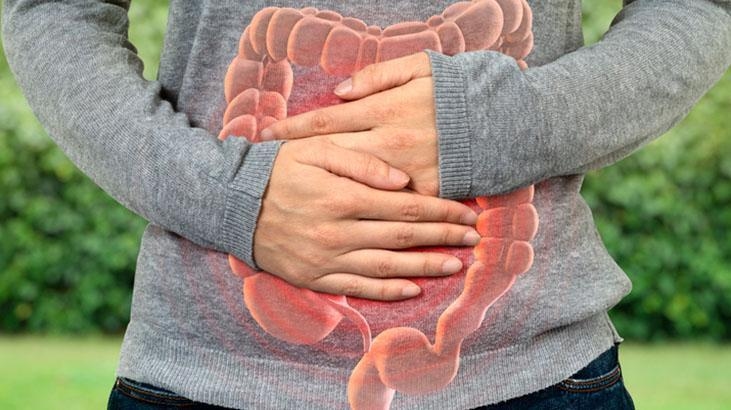 Non chiamatela una fuga del fine settimana! La sindrome dell'intestino permeabile può iniziare in 2 giorni