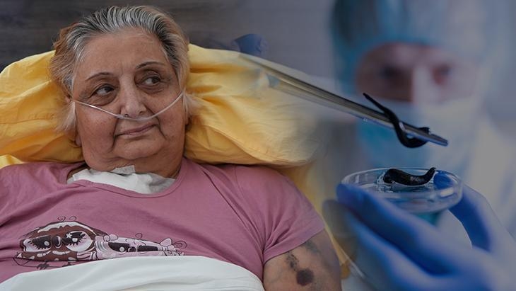 Wrong leech therapy was killing him! He stuck it on his neck, poisoning his entire body