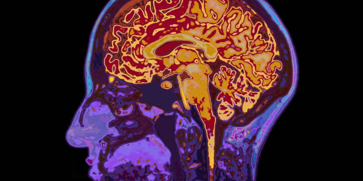 Cosa succede nel cervello quando cediamo alla tentazione? La neuroscienza della corruzione politica