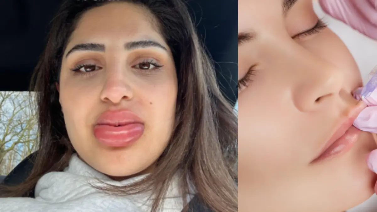 Jovem passou por tratamento estético e ficou parecendo uma boneca Bratz.