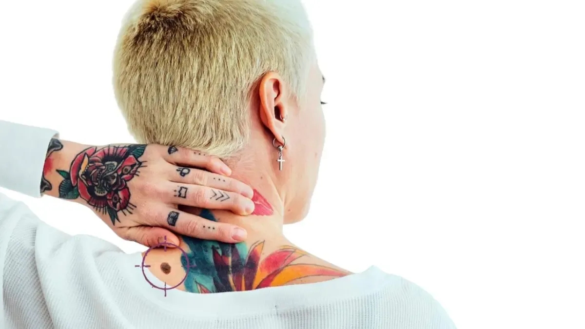 Tatuadores: los nuevos aliados para la detección temprana del cáncer de piel