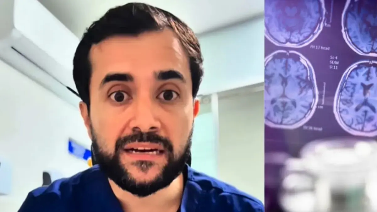 Leonardo Bello, neurologista: 'Para mim, o sintoma inicial do Alzheimer é a perda de massa muscular'
