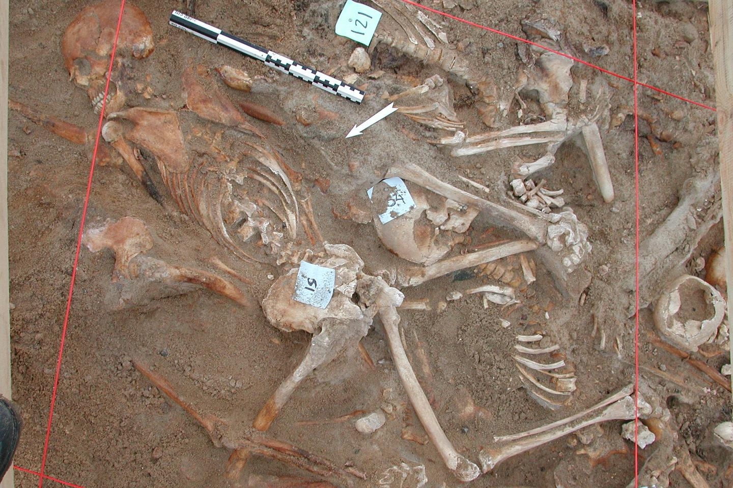 1812'de Napolyon'un Büyük Ordusunu yok eden bu enfeksiyonlar