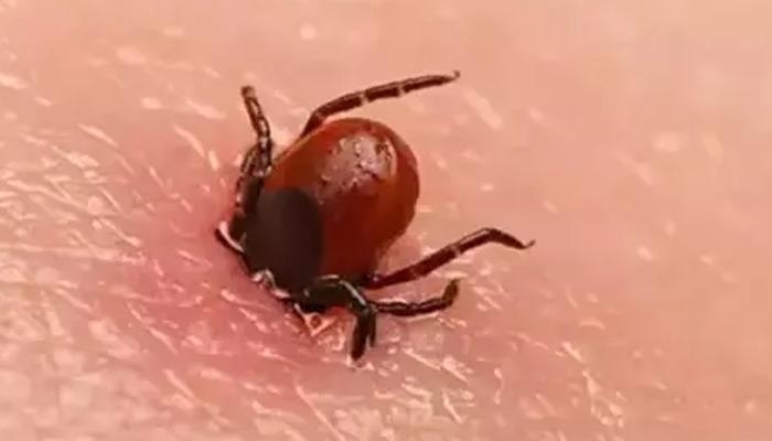 Tick; cannot be pulled out by hand, cannot be crushed with a nail! There is a 100 percent risk of infection! 4 people lost their lives: It sticks to these areas of the body in particular