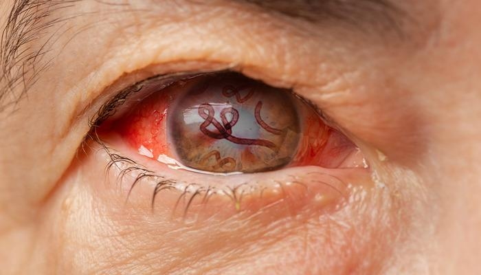 Horrific disease: Literally rotting from within! Ebola-like virus kills 8 people