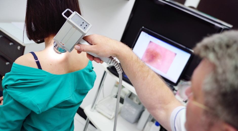 Vale la pena controllare i nei in estate. Un dermatologo spiega come funziona la dermatoscopia e perché è importante.
