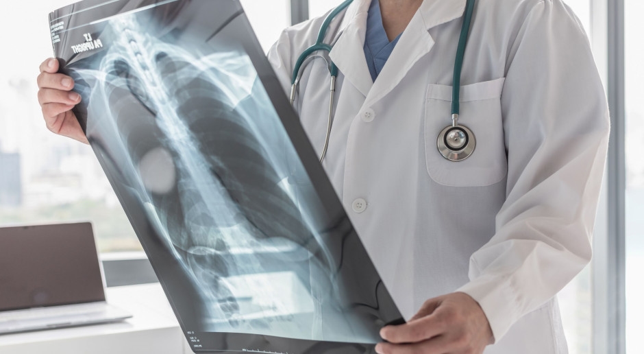 Jeunes non-fumeurs atteints d'un cancer du poumon avancé. Une seule mutation est responsable.