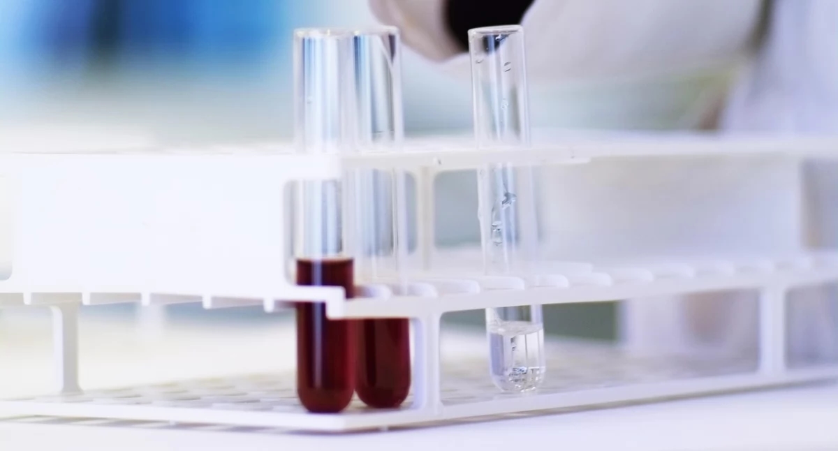 I diagnostici di laboratorio stanno emergendo dall'ombra. È stata lanciata una campagna sotto il patrocinio del Ministro della Salute.