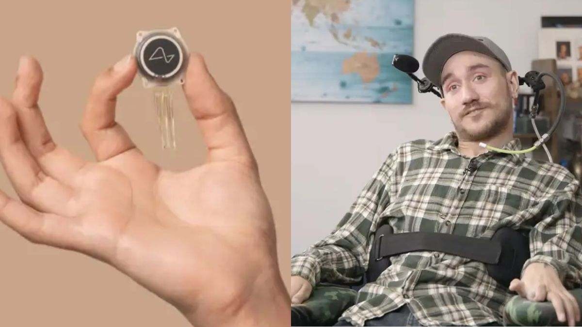 L'uomo a cui Musk ha impiantato il chip cerebrale mostra come sta 18 mesi dopo: "Non dovrebbe essere possibile..."