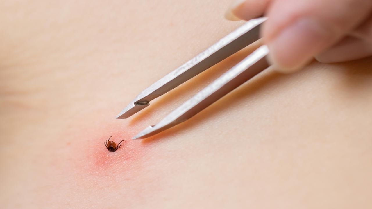 Early and correct intervention in tick bites prevents the disease