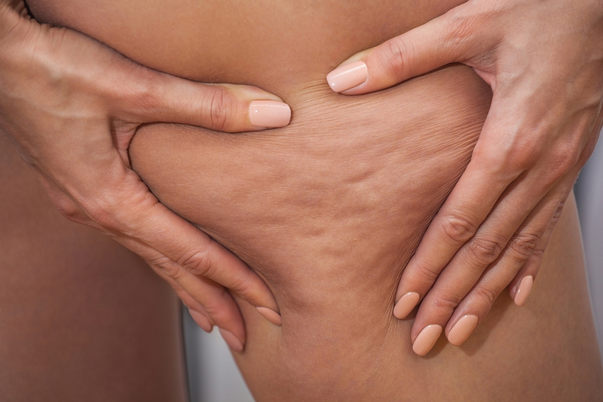 Entrenador personal revela cómo “eliminar” la celulitis con actividad física