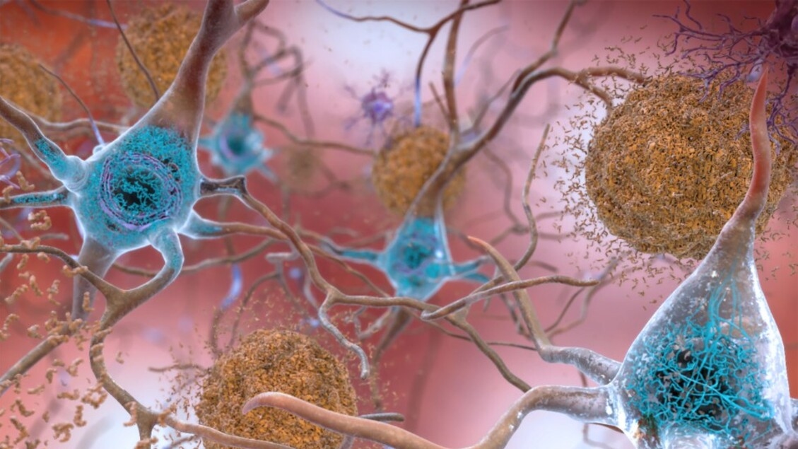 Uma proteína sintética contra doenças neurodegenerativas