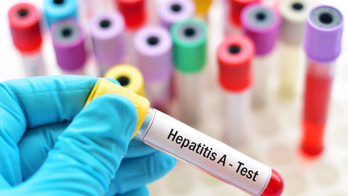 Ecdc, aumento de casos de hepatitis A en Europa