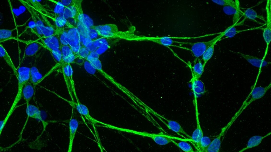 3D-geprinte organoïden voor de gepersonaliseerde geneeskunde van de toekomst