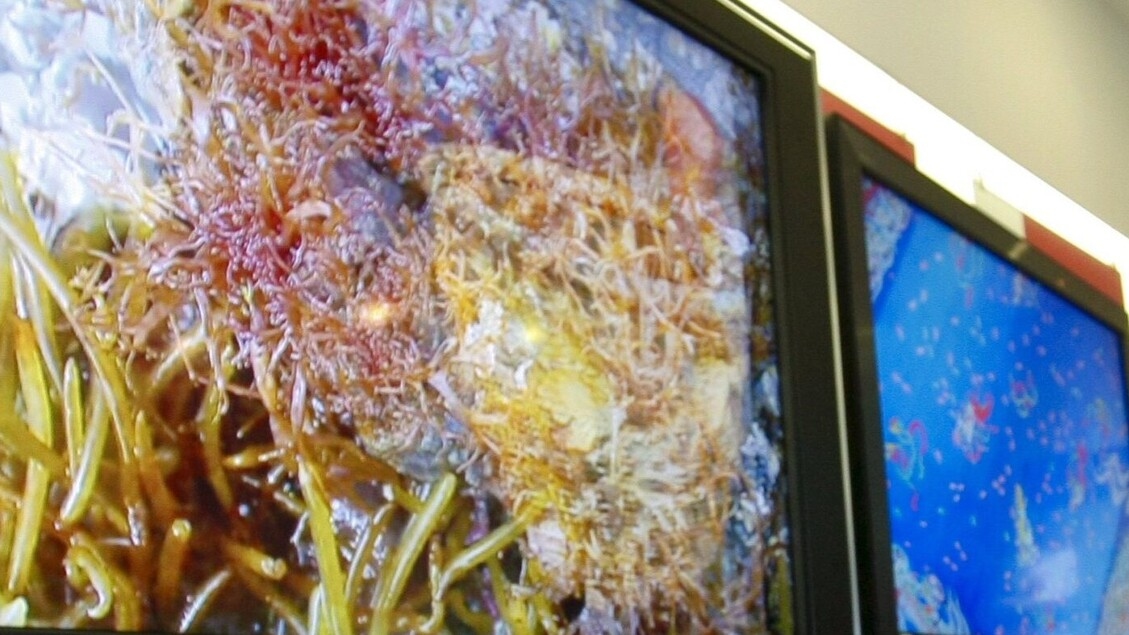 Das Fernsehen ist das erste Medium, aber mit einer personalisierten Umsetzung