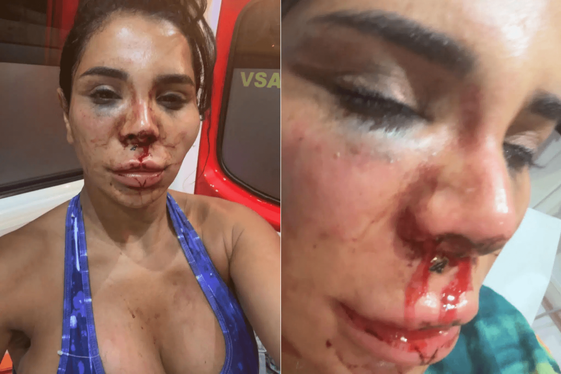 Influencer Soraya, victim of violent kidnapping: box cutters, acid, physical violence, tying up...