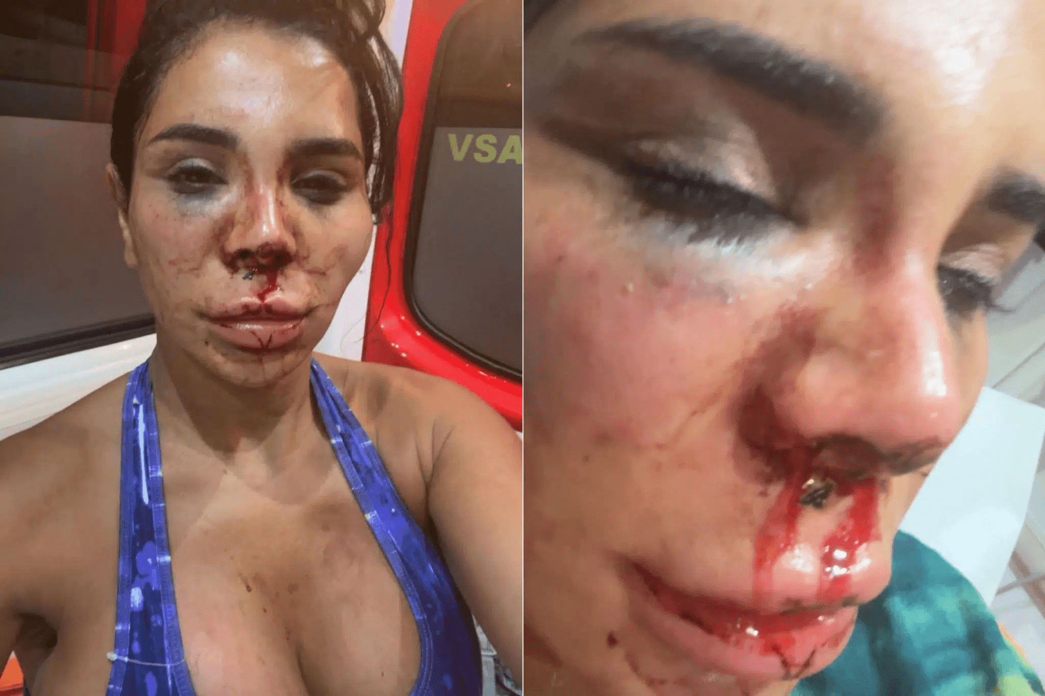 Influencer Soraya, victim of violent kidnapping: box cutters, acid, physical violence, tying up...