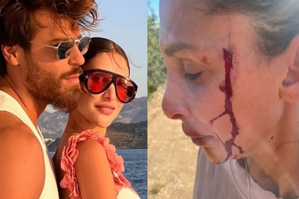 Sara Bluma, de vriendin van Can Yaman, doet aangifte van mishandeling door haar ex: schokkende foto / Can Yaman: "Ik hou van je en zal je steunen."