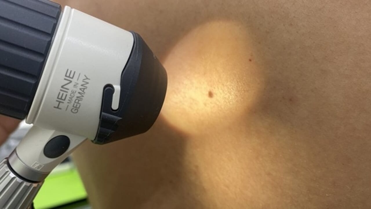Consultas dermatológicas gratuitas para sus empleados: la iniciativa de la empresa Alta