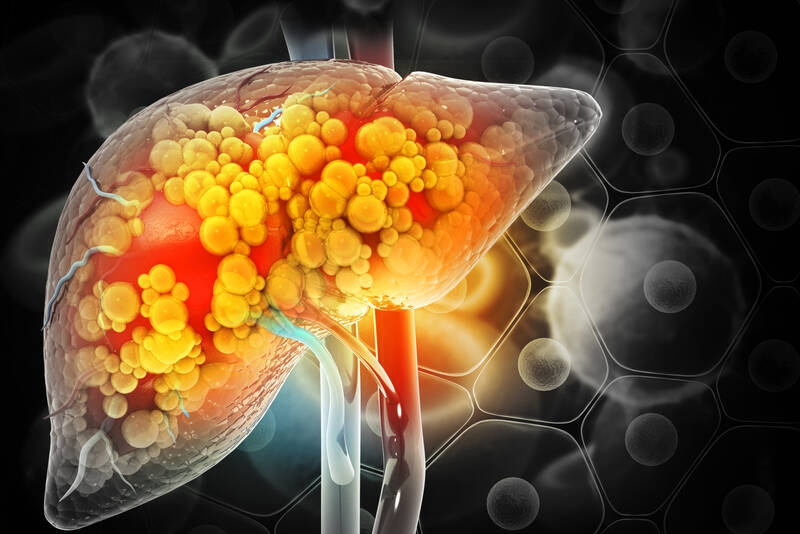 Resmetirom: Luz verde para o primeiro medicamento contra fibrose hepática