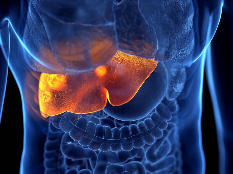 Electrochemotherapy: an option for liver cancer