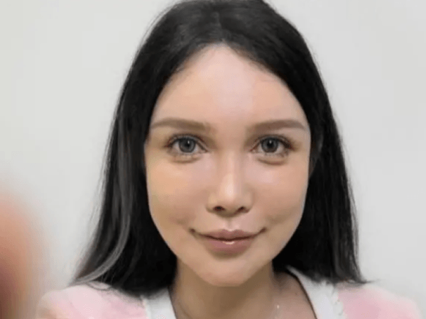 El 'boom' de la cirugía estética en China: mujer se ha operado más de 100 veces