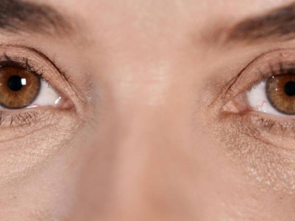 Have you ever seen 'worms' floating in your eyes? These are what those spots are.