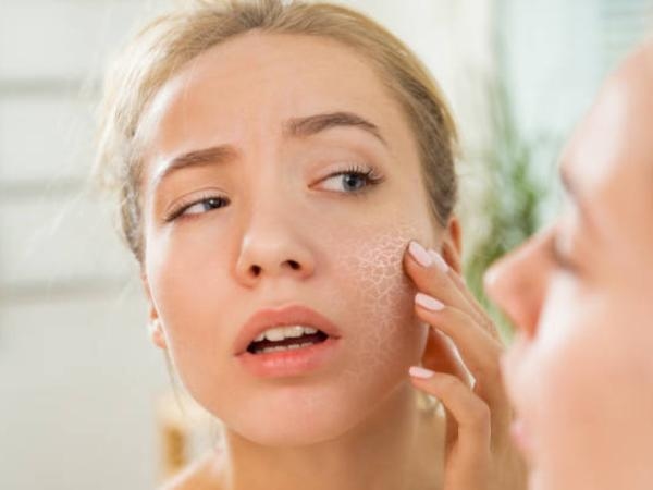 Pele escamosa e olhos secos: a falta dessa vitamina pode arruinar seu corpo