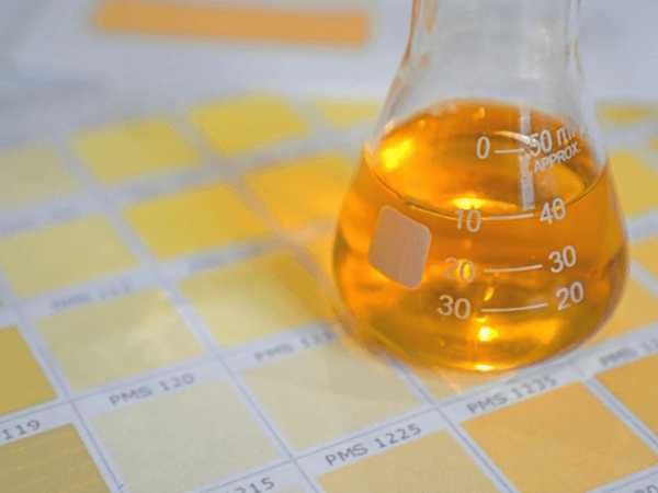 Don't ignore it: there are 6 types of urine and each one can reveal an important disease