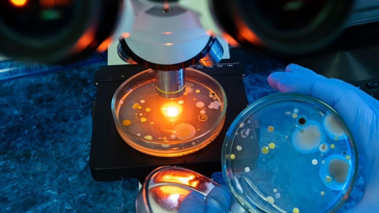Batteri carnivori presenti in questi luoghi: cosa devi sapere per proteggerti