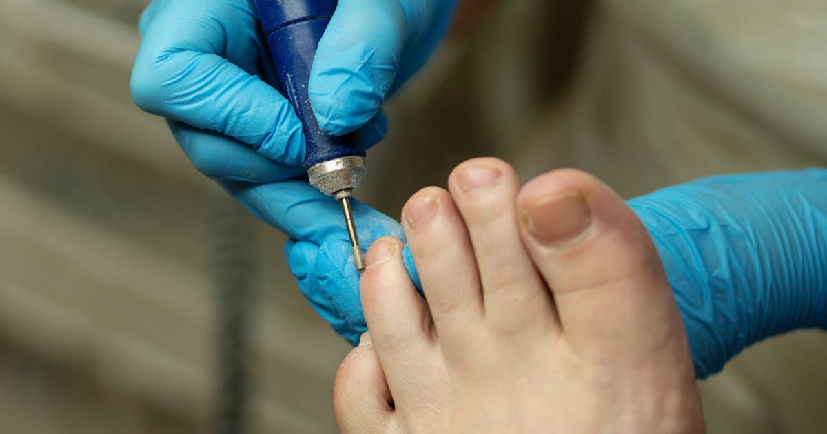 Health. Your toenails can reveal your risk of lung cancer.