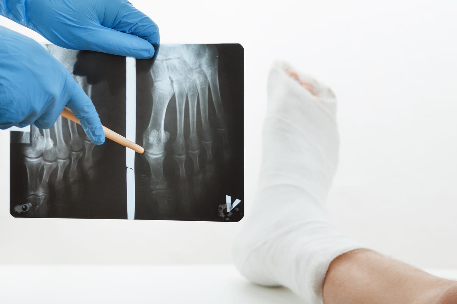 Après 50 ans, il faut éviter de manger ces aliments : ils sont mauvais pour les os