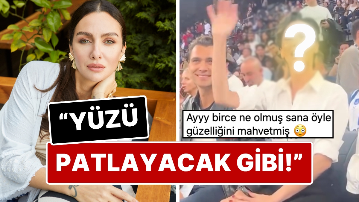 Has the Plastic Surgery Been Overdone? Those Who See Birce Akalay's Latest Face Couldn't Help Comparing It With Her Previous Natural Look!