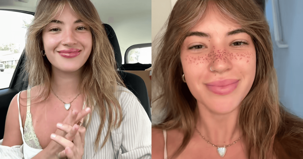 Tendência ou polêmica? Influenciadora tatua sardas no rosto e viraliza nas redes sociais