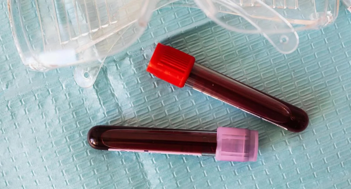 Lymphocytes (LYM) in the blood – norms, functions, decreased and increased results