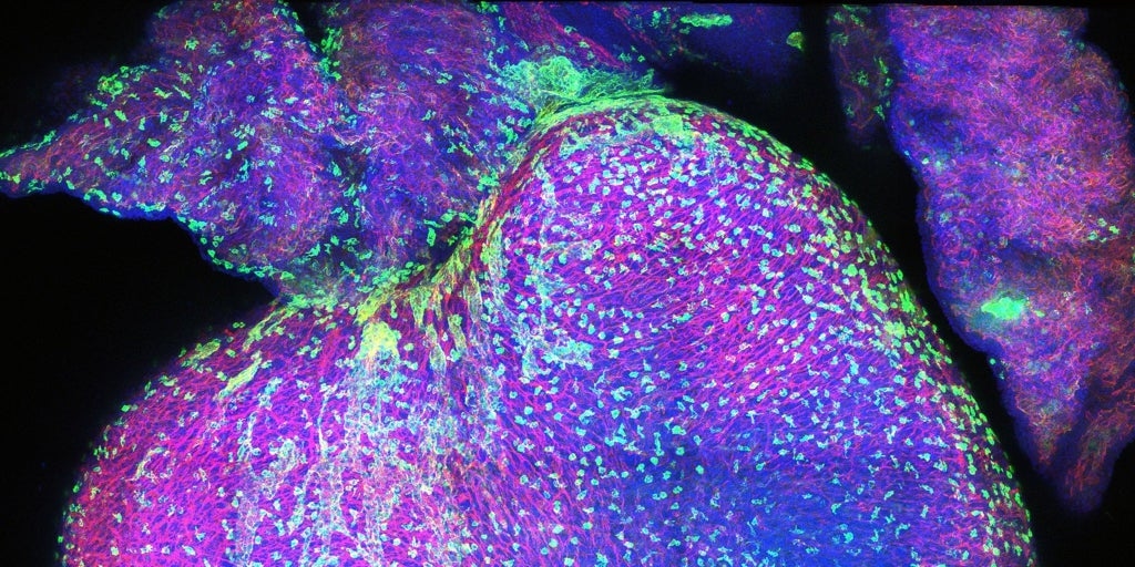 На этой карте показано, как выглядит сердце человека во время внутриутробного развития.