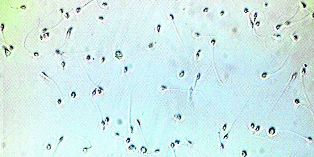 L'IA parvient à une grossesse impossible après avoir détecté seulement deux spermatozoïdes viables chez un homme.