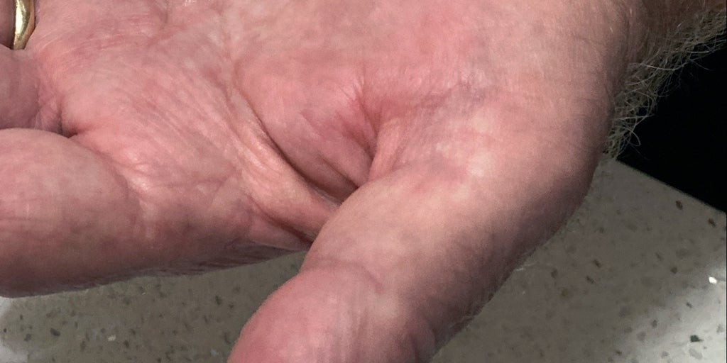 Los suplementos de melatonina no son tan inofensivos como se cree