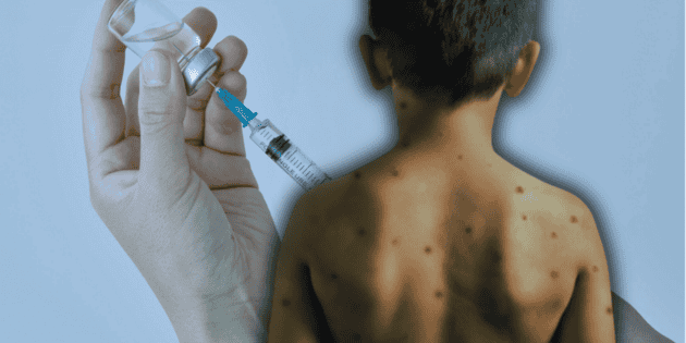 Measles cases detected in two schools in Zapopan