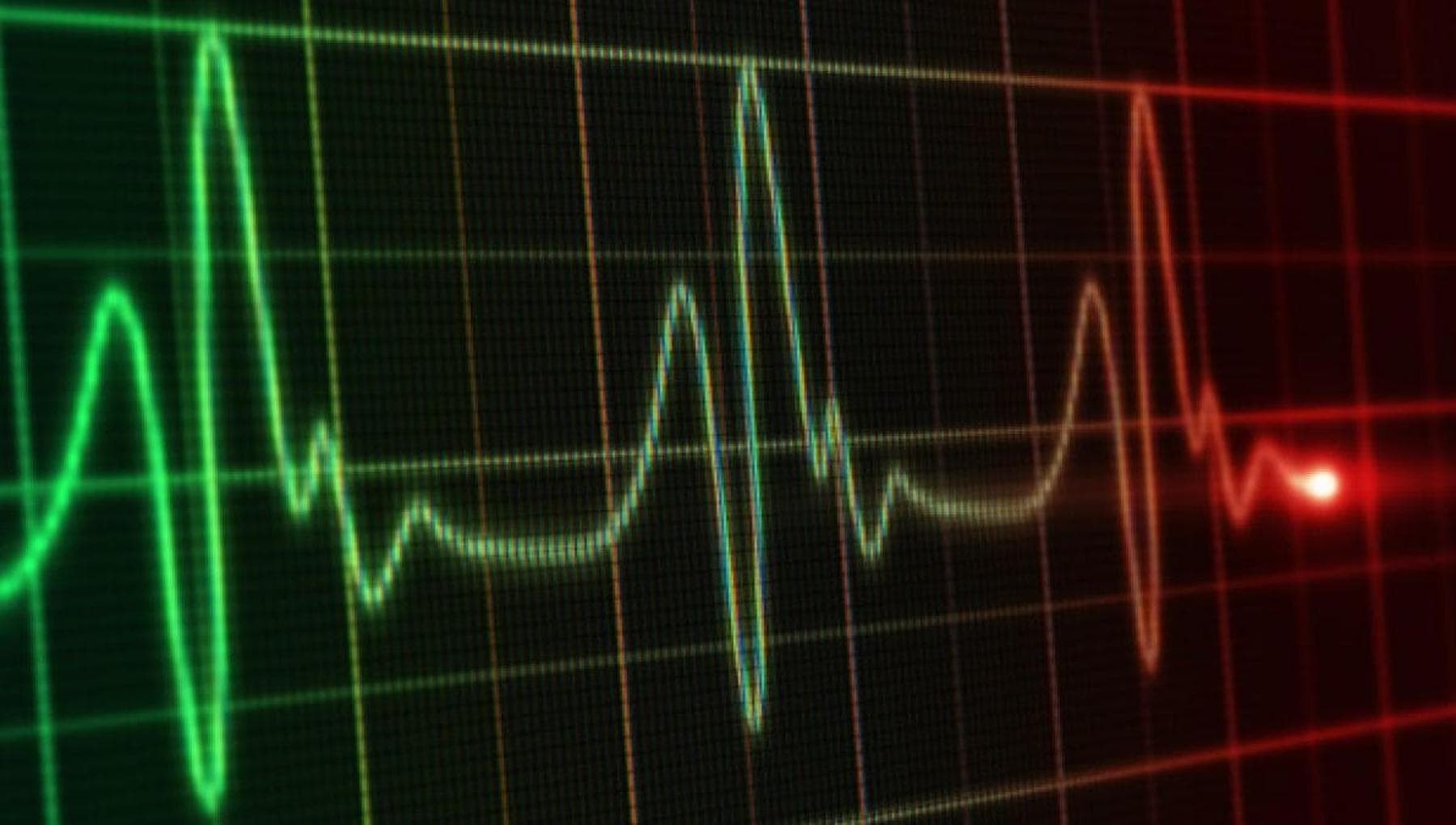 Heart attack: Artificial Intelligence provides tailored treatments for the most complex cases.