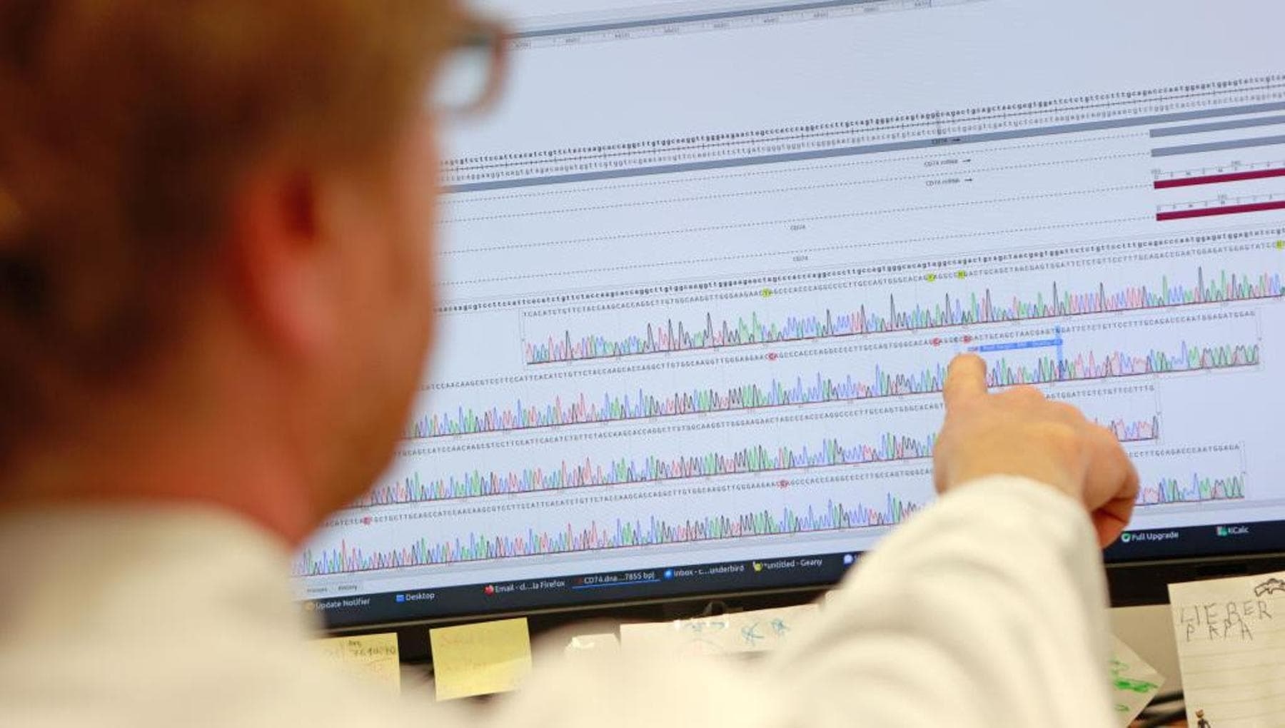 Voici les gènes du cholestérol qui augmentent le risque de crise cardiaque.