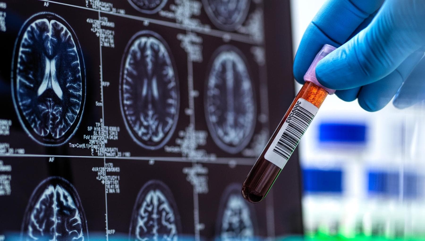 Hafıza (ve daha fazlası) risk altında: Beyin, kan basıncının iniş çıkışlarıyla yaşlanıyor